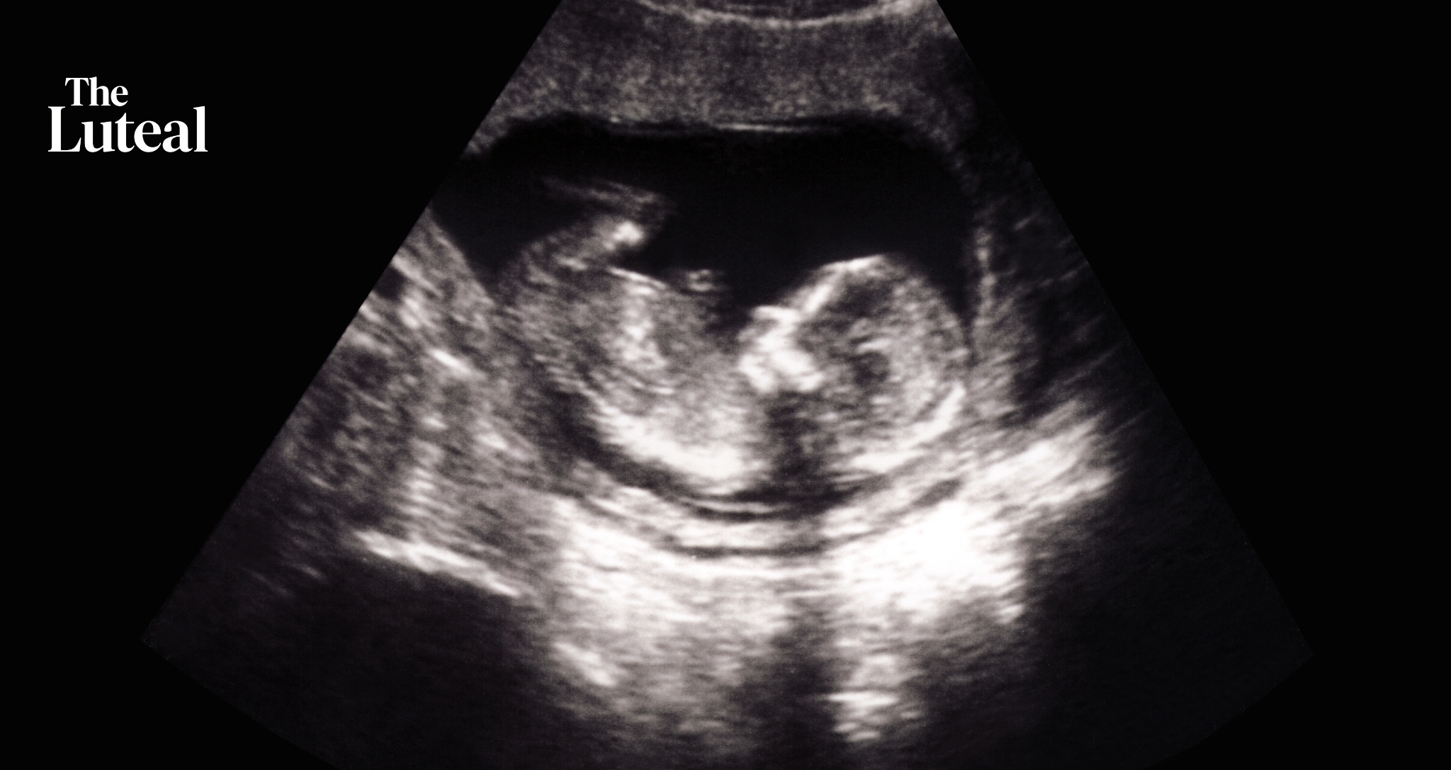 The Cells a Pregnancy Leaves Behind Built a Billion-dollar Industry