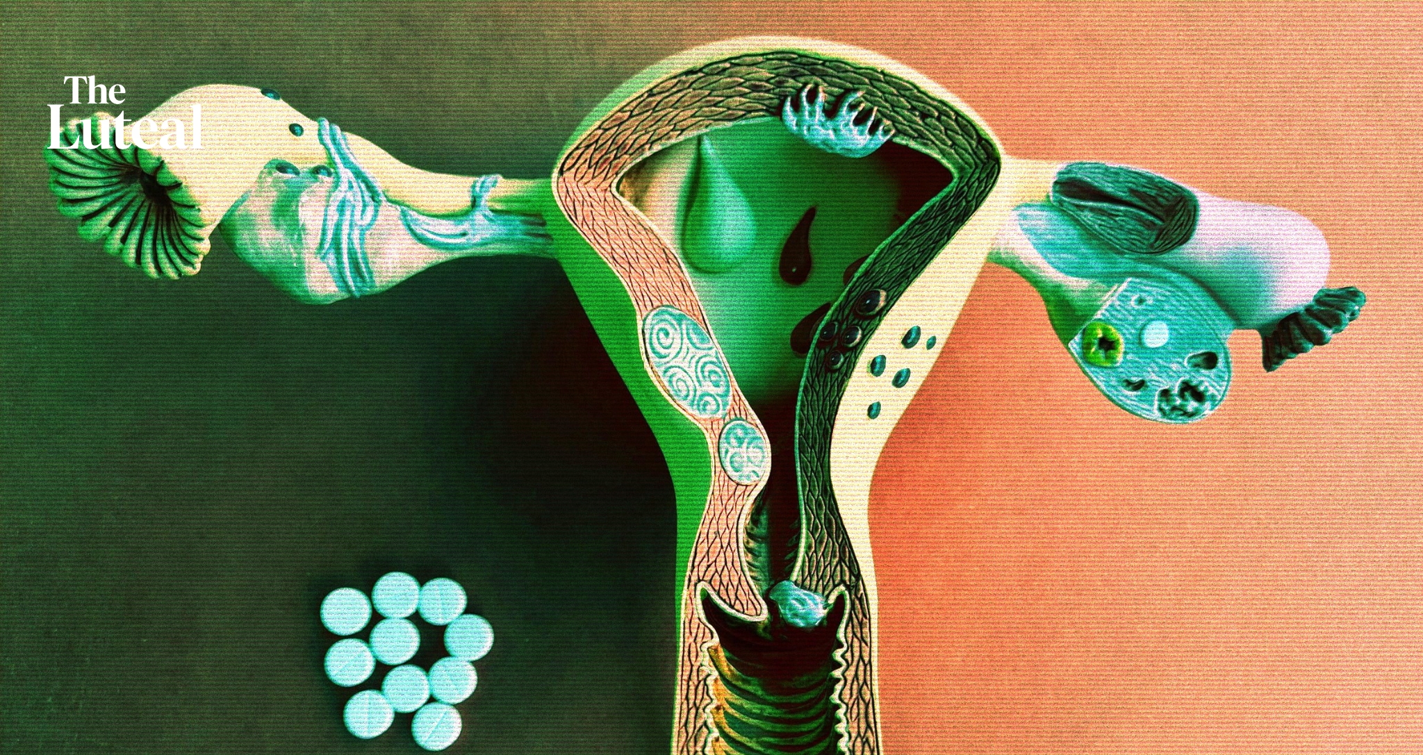Surgery Was the Only Way to Diagnose Endometriosis. Australia Just Changed That
