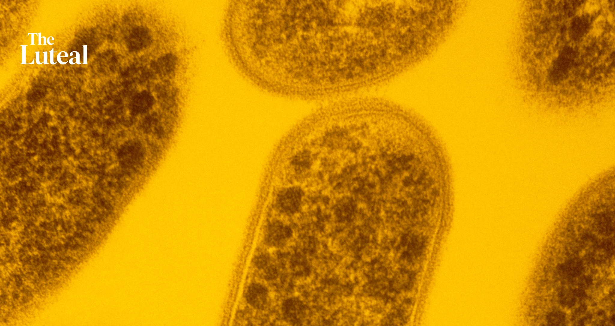 Bacterial Vaginosis Comes Back for Half of Women. One Swab Flags Who's at Risk